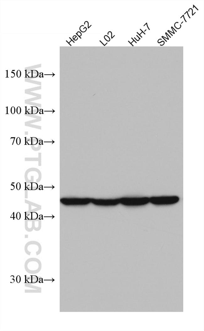 AGXT Antibody in Western Blot (WB)