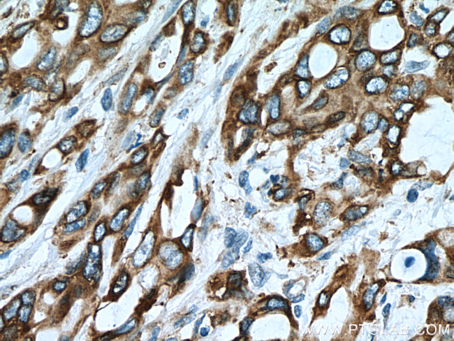 ERO1L Antibody in Immunohistochemistry (Paraffin) (IHC (P))