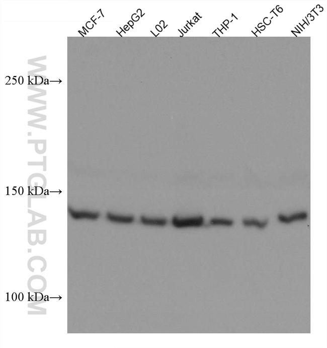 PEX1 Antibody in Western Blot (WB)