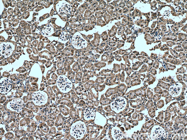 Arfaptin-1 Antibody in Immunohistochemistry (Paraffin) (IHC (P))