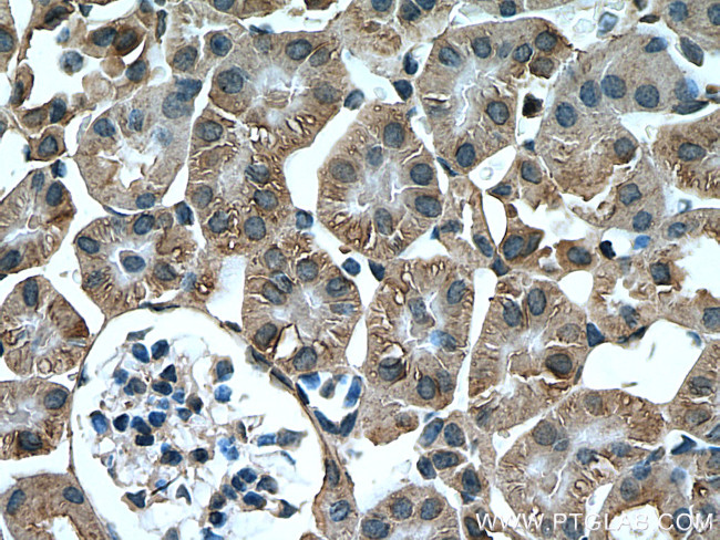 Arfaptin-1 Antibody in Immunohistochemistry (Paraffin) (IHC (P))