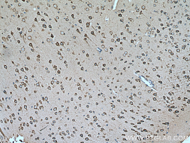 SLC25A12 Antibody in Immunohistochemistry (Paraffin) (IHC (P))