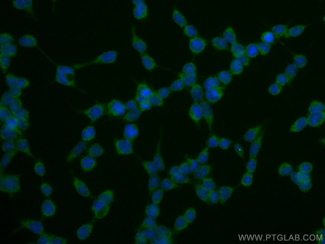 SOD1 Antibody in Immunocytochemistry (ICC/IF)