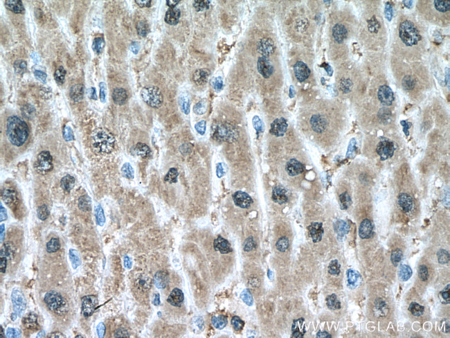 SOD1 Antibody in Immunohistochemistry (Paraffin) (IHC (P))