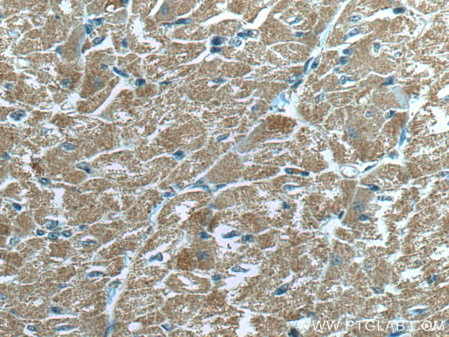 MFN2 Antibody in Immunohistochemistry (Paraffin) (IHC (P))