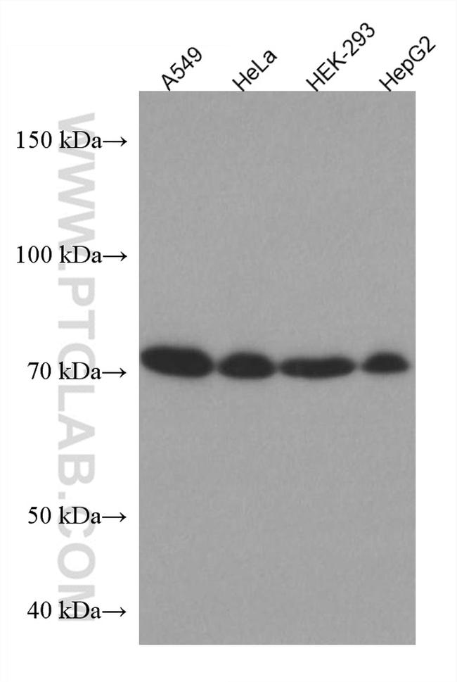 HRD1/SYVN1 Antibody in Western Blot (WB)