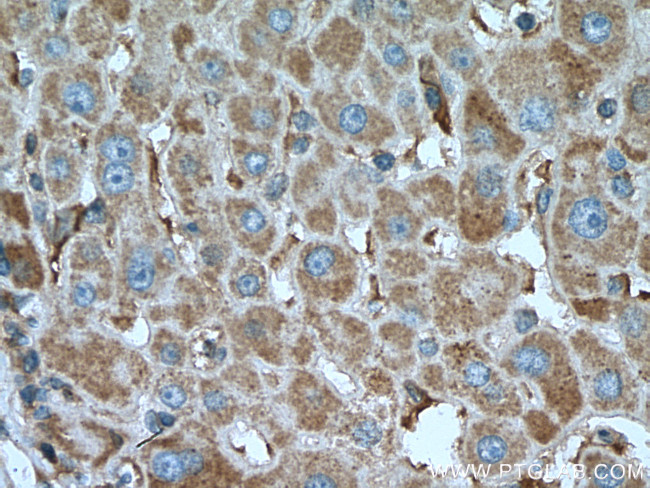 GNB3 Antibody in Immunohistochemistry (Paraffin) (IHC (P))