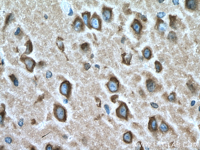 RAB2A Antibody in Immunohistochemistry (Paraffin) (IHC (P))