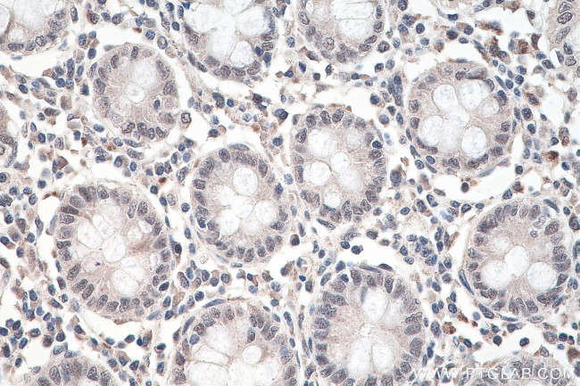 RBM15B Antibody in Immunohistochemistry (Paraffin) (IHC (P))