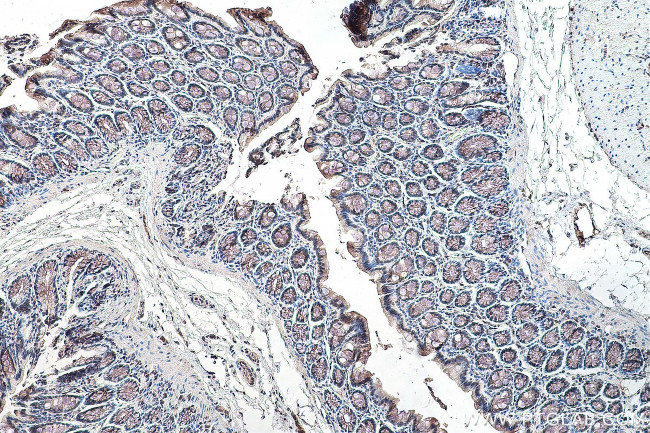 RBM15B Antibody in Immunohistochemistry (Paraffin) (IHC (P))