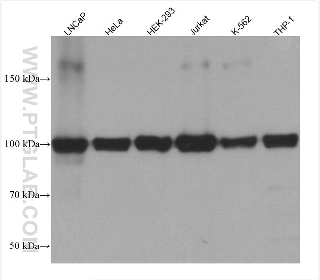 RBM15B Antibody in Western Blot (WB)