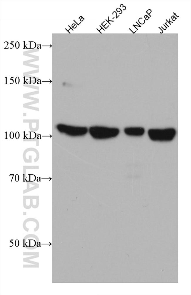 RBM15B Antibody in Western Blot (WB)