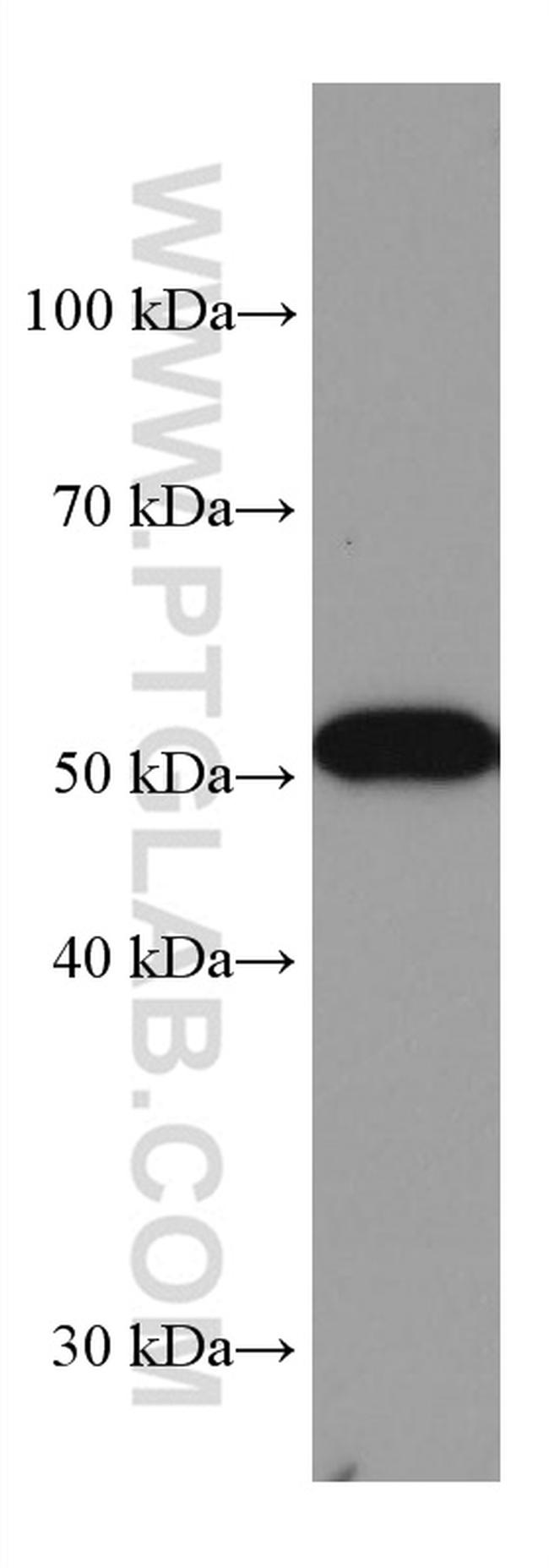 GPT/ALT1 Antibody in Western Blot (WB)