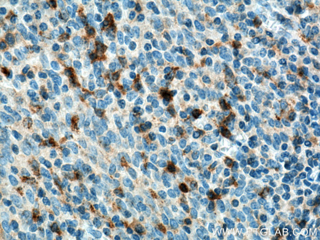 KLRB1/CD161 Antibody in Immunohistochemistry (Paraffin) (IHC (P))