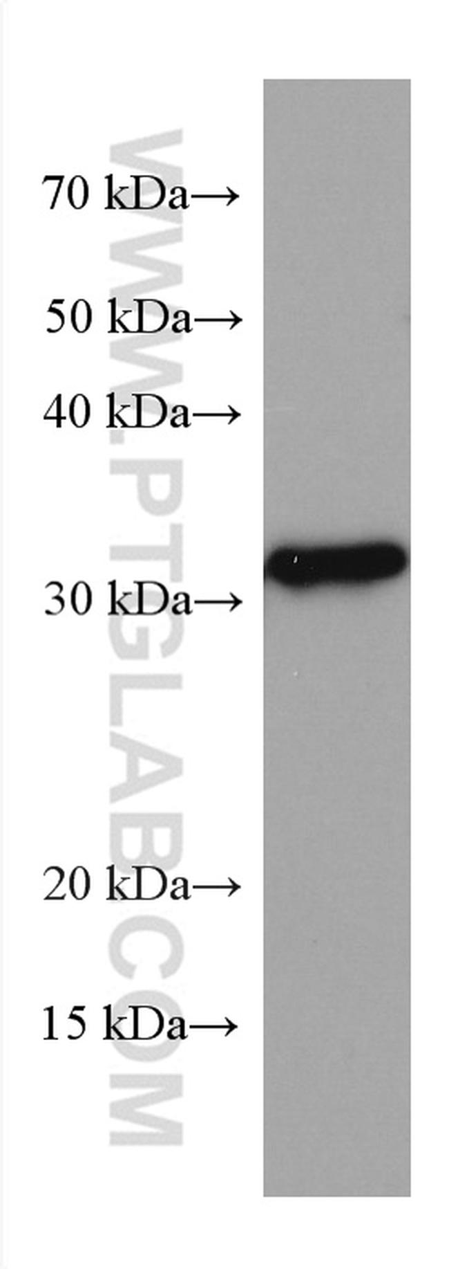KLRB1/CD161 Antibody in Western Blot (WB)