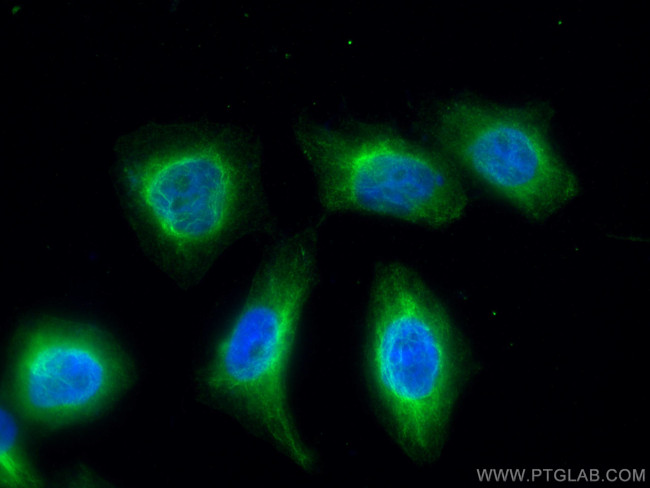 UAP1 Antibody in Immunocytochemistry (ICC/IF)