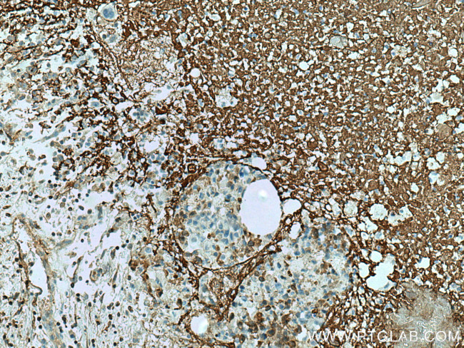 Collagen Type V Antibody in Immunohistochemistry (Paraffin) (IHC (P))