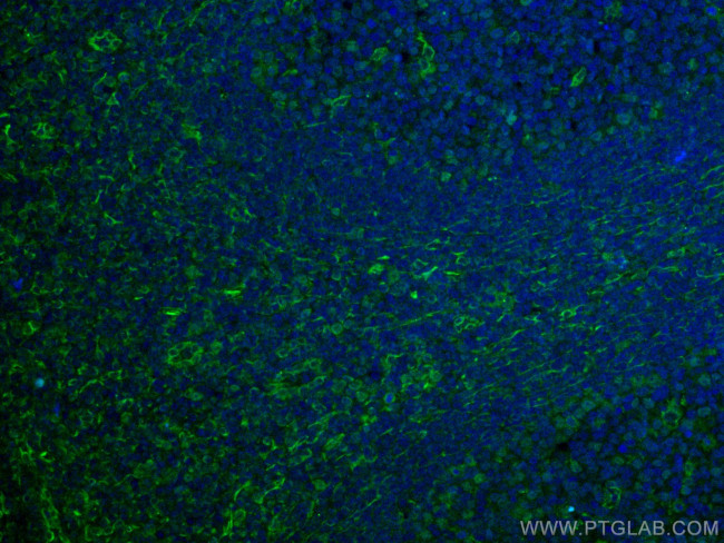 CD63 Antibody in Immunohistochemistry (Paraffin) (IHC (P))