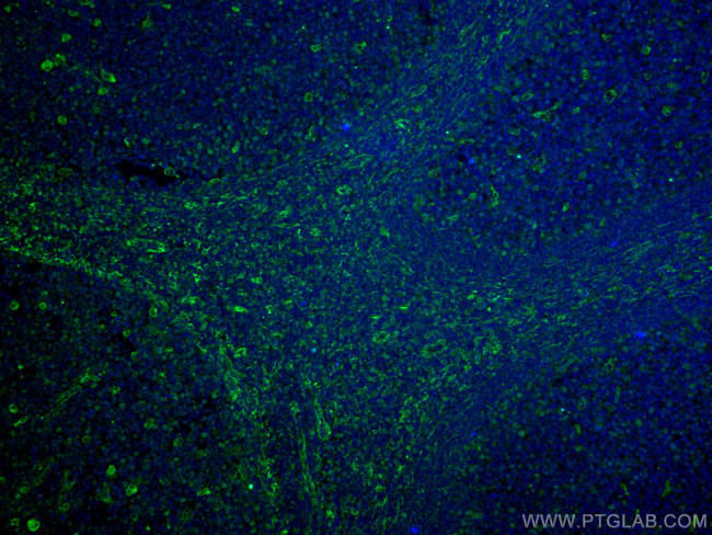 CD63 Antibody in Immunohistochemistry (Paraffin) (IHC (P))