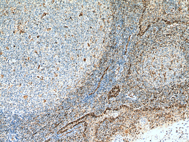 CD63 Antibody in Immunohistochemistry (Paraffin) (IHC (P))