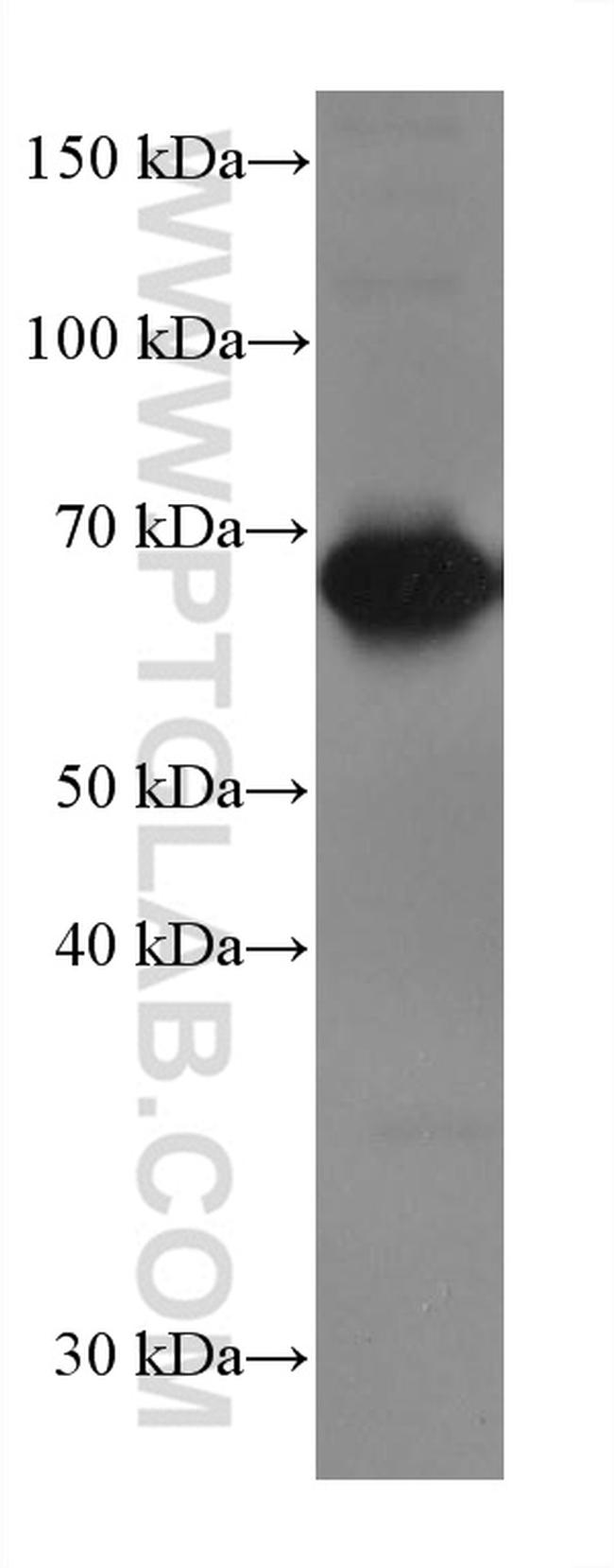 CD226 Antibody in Western Blot (WB)