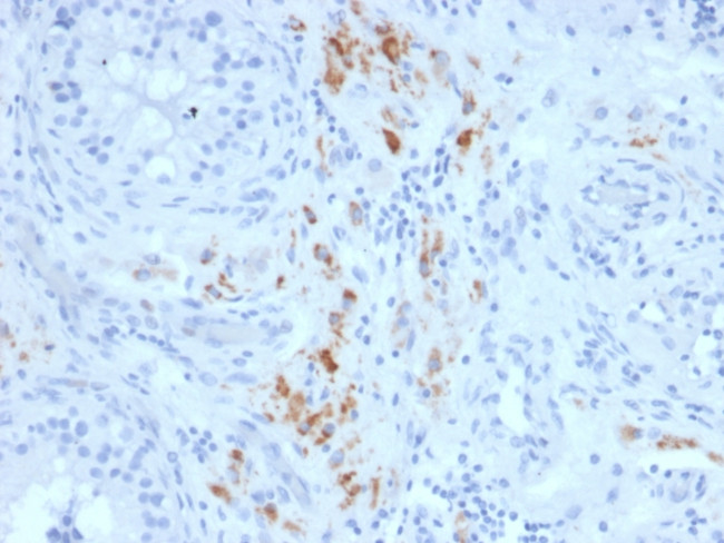 StAR (Steroidogenic Acute Regulator) Antibody in Immunohistochemistry (Paraffin) (IHC (P))