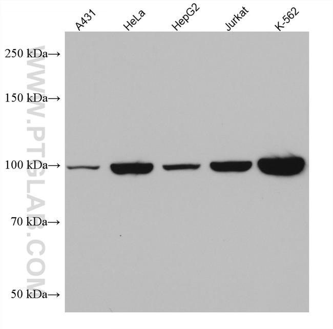 ALIX/AIP1 Antibody in Western Blot (WB)