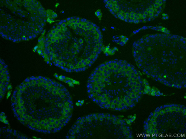 Cyclin B2 Antibody in Immunohistochemistry (Paraffin) (IHC (P))