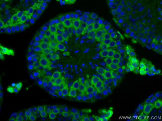 Cyclin B2 Antibody in Immunohistochemistry (Paraffin) (IHC (P))