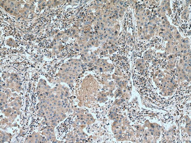 Cyclin B2 Antibody in Immunohistochemistry (Paraffin) (IHC (P))