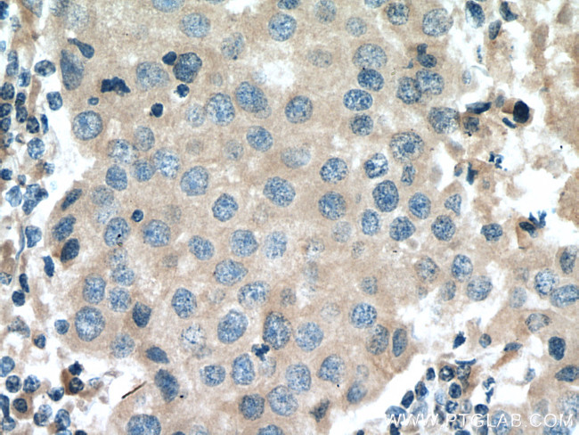 Cyclin B2 Antibody in Immunohistochemistry (Paraffin) (IHC (P))