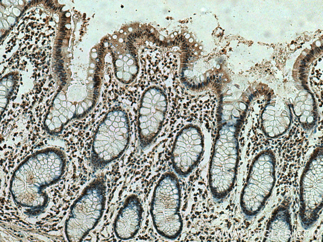 ING4 Antibody in Immunohistochemistry (Paraffin) (IHC (P))