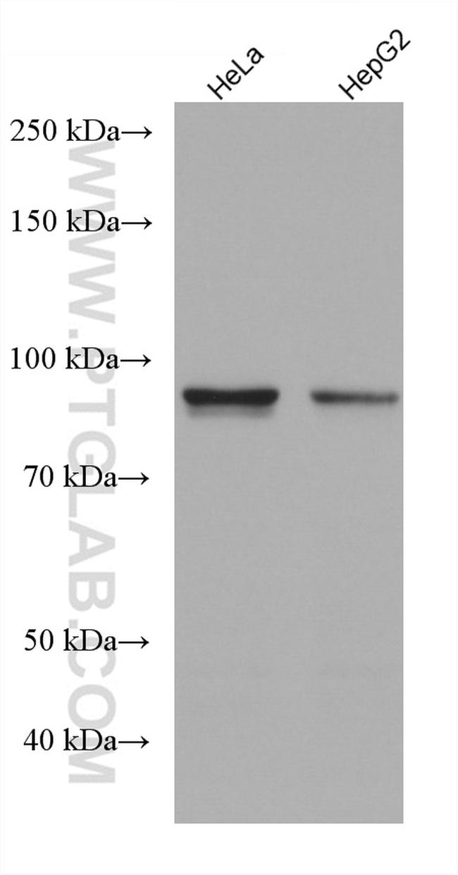 ADARB1 Antibody in Western Blot (WB)