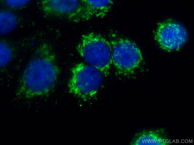 citrate synthase Antibody in Immunocytochemistry (ICC/IF)