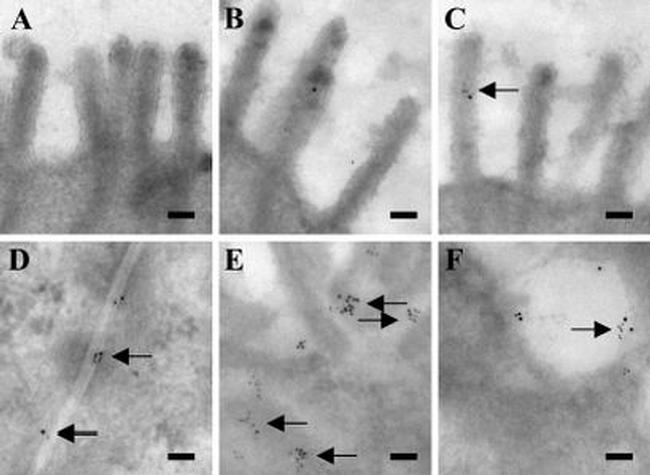 Leptin Antibody in Immunomicroscopy (IM)