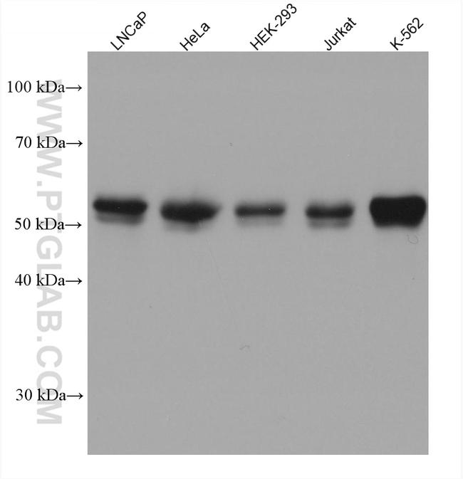 PKMYT1 Antibody in Western Blot (WB)