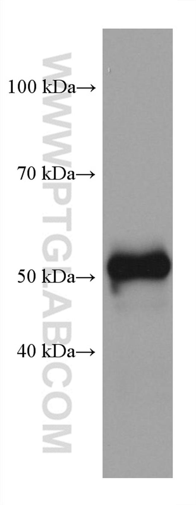 OXCT1 Antibody in Western Blot (WB)
