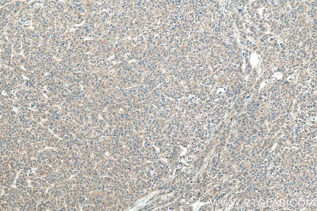 VAPA Antibody in Immunohistochemistry (Paraffin) (IHC (P))