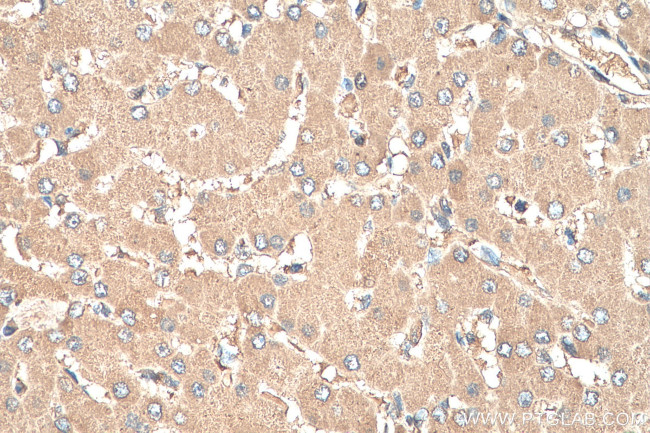 AFP Antibody in Immunohistochemistry (Paraffin) (IHC (P))