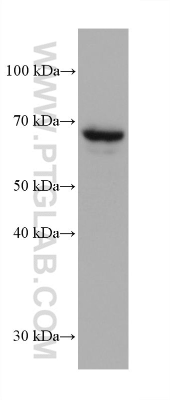 AFP Antibody in Western Blot (WB)