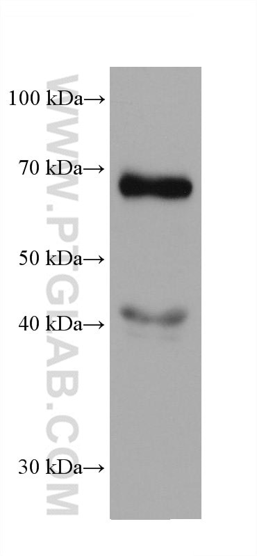 AFP Antibody in Western Blot (WB)