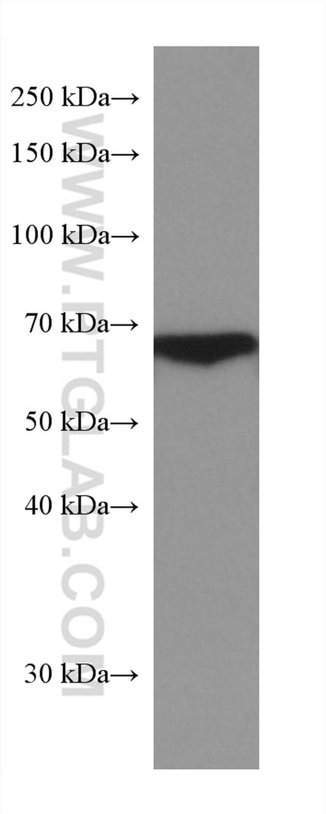 HABP2 Antibody in Western Blot (WB)