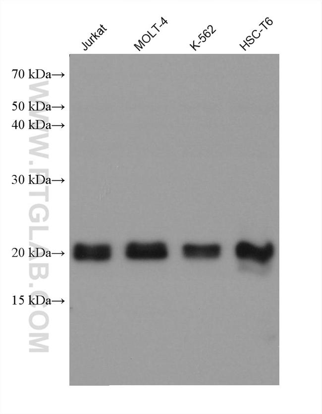 CBFB Antibody in Western Blot (WB)