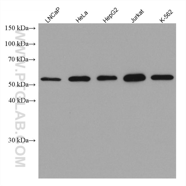 KPNA3 Antibody in Western Blot (WB)