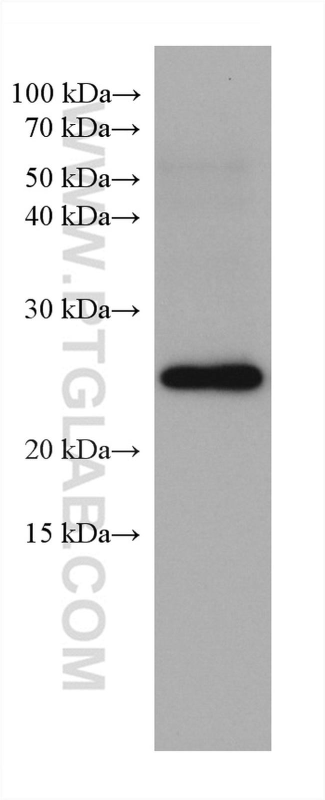 RAB11A Antibody in Western Blot (WB)