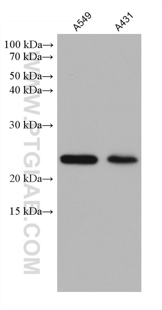 RAB11A Antibody in Western Blot (WB)