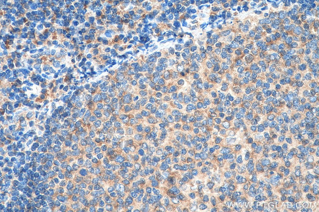 ValRS Antibody in Immunohistochemistry (Paraffin) (IHC (P))