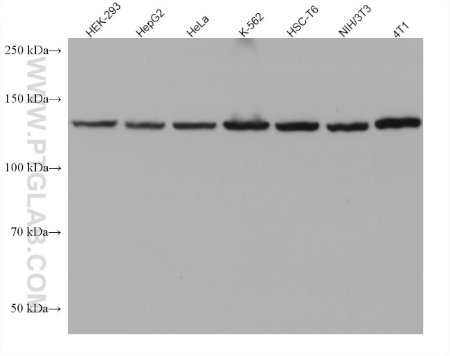 ValRS Antibody in Western Blot (WB)