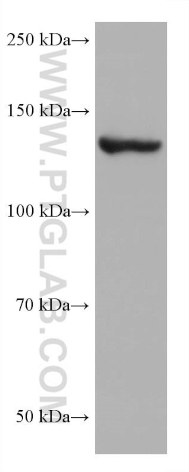 ValRS Antibody in Western Blot (WB)