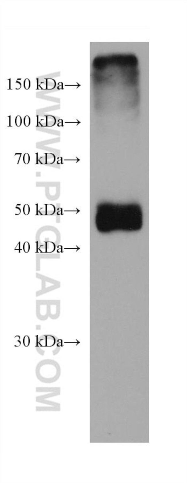 SHMT1 Antibody in Western Blot (WB)